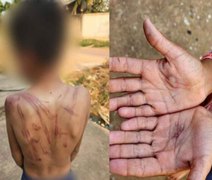 Mãe espanca e queima mãos de filho com isqueiro por causa de 10 reais