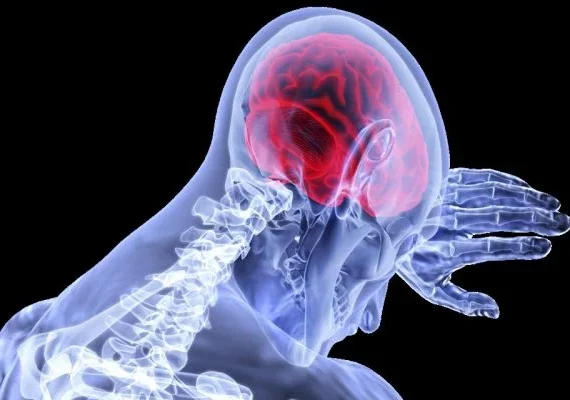 Cientistas apontam 7 hábitos para evitar AVC; Saiba quais