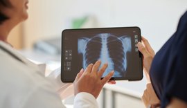 Anvisa aprova medicamento para hipertensão pulmonar