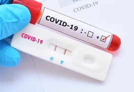 Numero de mortes pela covid-19 em AL continua em queda