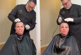 Gretchen raspa cabelo ao vivo antes de transplante capilar contra alopecia