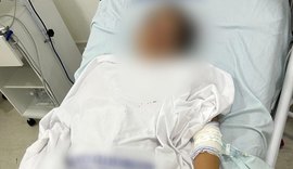 Ex invade casa, esfaqueia mulher e foge após ataque em Murici