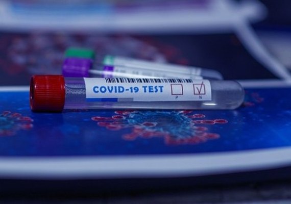 Casos confirmados da covid-19 em Alagoas passa de 46 mil