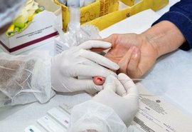 Em 32 anos, Estado de Alagoas registra mais de 6.800 casos diagnosticados de Aids