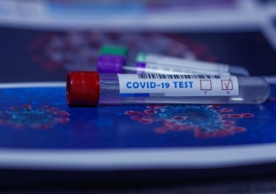 Brasil passa de 2,2 milhões de pessoas infectadas com o novo coronavírus