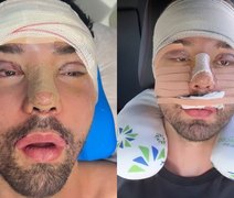 Rico Melquíades faz cirurgias no rosto e desabafa: 'Não aguentava mais ser chamado de feio'