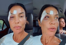 Após susto, Ivete Sangalo tranquiliza fãs e explica diagnóstico