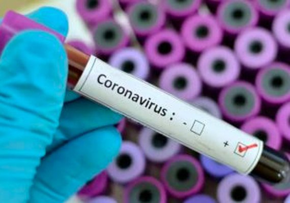 Arapiraca registra primeiro caso suspeito de coronavírus