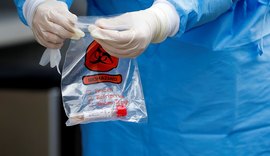 Estudo indica que maioria de infectados cria anticorpos