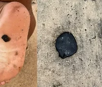 Manchas de óleo voltam a aparecer nas praias de Maceió