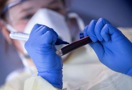 Alagoas confirma mais 263 casos do novo Coronavírus