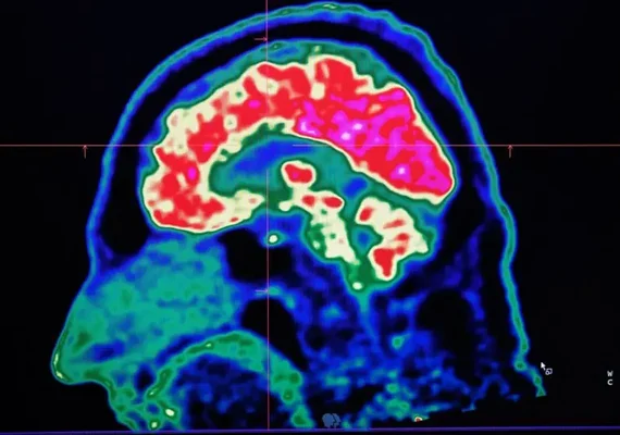 Altas temperaturas e calor têm afetado os nossos cérebros, afirmam especialistas