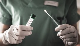 TCU diz que governo atrasa compra de testes para a covid-19 há 4 meses