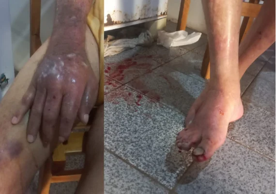 Filha é presa por maus-tratos após idoso de 84 anos ser encontrado com várias lesões