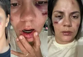 Mulher é arremessada de montanha-russa em parque aquático recém-inaugurado: ‘Desesperador’