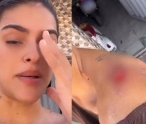 Passageira denuncia perseguição após salto de moto por aplicativo em Maceió