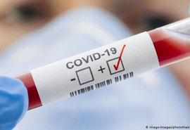 Estado confirma mais 170 casos e 16 óbitos pela covid-19