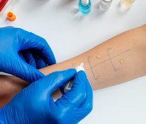 Médico do Hospital Ib Gatto orienta alérgicos sobre prevenção e cuidados
