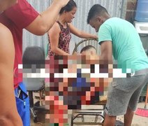 Jovem sofre ataque a tiros no conjunto Gama Lins, em Maceió