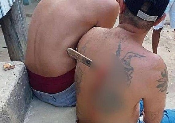 Homem esfaqueado após discussão fica com faca cravada nas costas