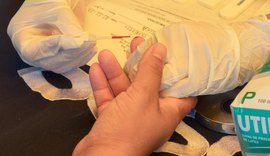 HIV, Aids e outras ISTs: Saiba como ter acesso ao tratamento pelo SUS em Maceió