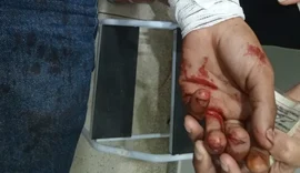 Em AL, homem é esfaqueado no peito e suspeito é detido pela Guarda Municipal