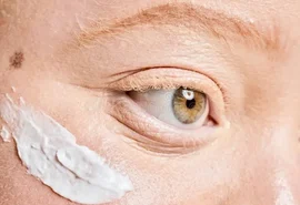 Pessoas com albinismo têm acesso gratuito a protetor solar em Maceió