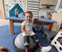 Após desvio de doações, criança amputada recebe próteses