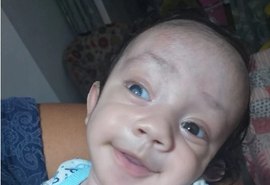 Bebê de sete meses precisa de doação para realizar procedimento cirúrgico