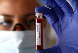 Alagoas confirma mais 210 casos do novo coronavírus em 24 horas