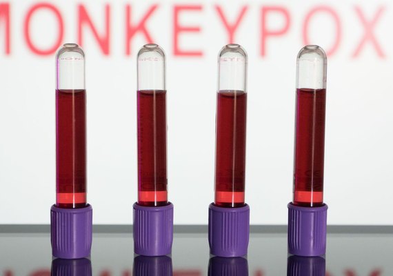Primeiras vacinas contra varíola dos macacos devem chegar ao Brasil em setembro