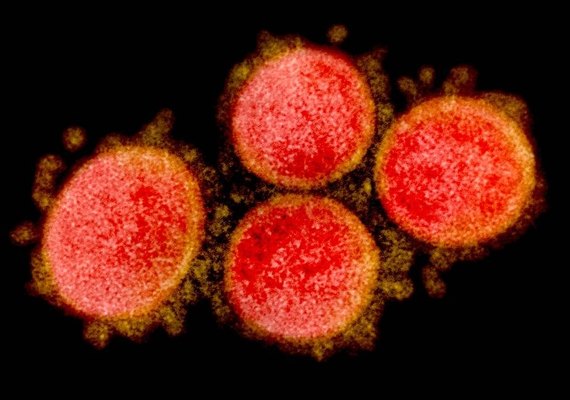 Grupo recruta voluntários para se infectarem de propósito com Covid-19 em estudo de vacina