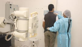 Hospital Ib Gatto realiza 2.744 exames de radiologia no terceiro trimestre