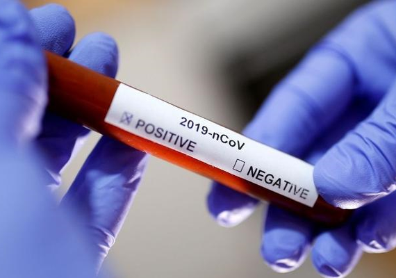 Alagoas registra 816 novos casos de Covid-19