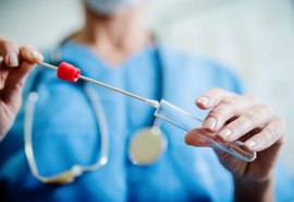 Exame RT-PCR será prescrito para alagoanos com Síndrome Gripal