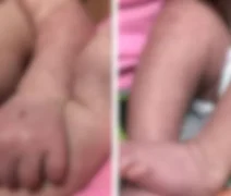 Bebê nascido há pouco mais de 20 dias morre de dengue em Maceió