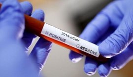 Alagoas registra mais 864 casos de covid-19 em 24 horas