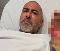 Fogaça revela que quase morreu em acidente de moto: 'Peguei óleo na pista'