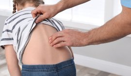 Mochila pesada pode comprometer a saúde de crianças e adolescentes, alerta ortopedista