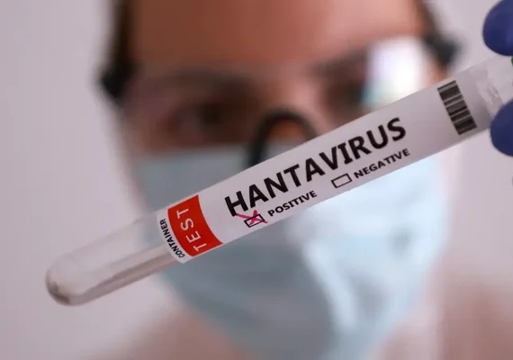 Duas pessoas retiradas de navio testam positivo para o hantavírus
