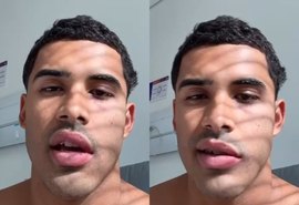 Cantor Nilo pausa carreira após diagnóstico de paralisia de Bell