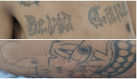 Vítima de agressão procura por familiares em Arapiraca