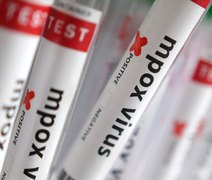 Casos confirmados de Mpox chegam a 140 no Brasil em 2026