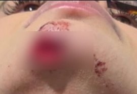 Influencer relata ter sido agredida por ex em bairro da parte alta