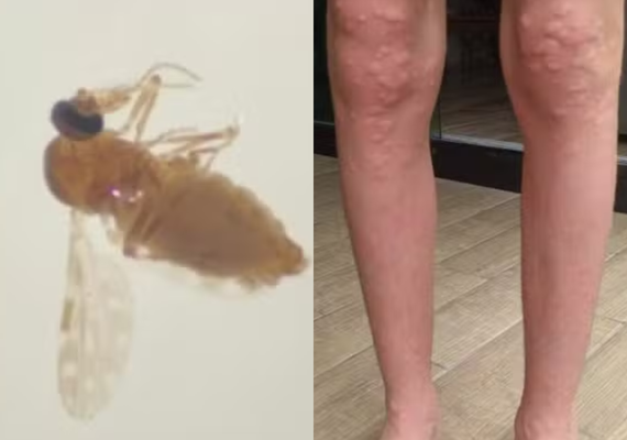 Conheça o mosquito que fez moradores em SC se 'trancarem' em casa