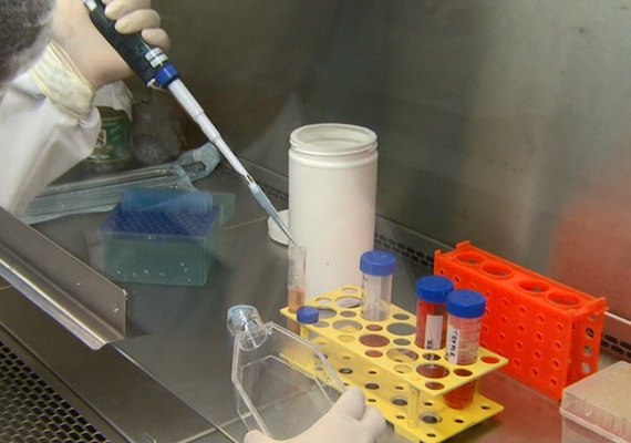 Lacen já realizou mais de 1.500 exames de detecção do novo coronavírus