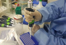 Exame para identificar Zika vírus é comercializado no país