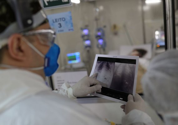 Casos de síndrome respiratória aguda grave caem no Brasil