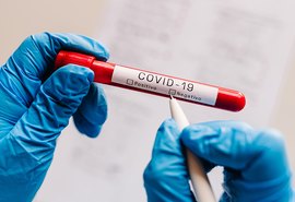 Pandemia dá sinais de controle em Alagoas, segundo Observatório da Ufal