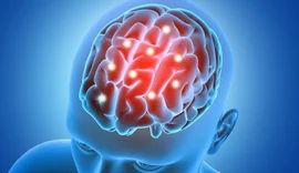 Marcapasso cerebral ajuda no tratamento do Parkinson e do TOC grave